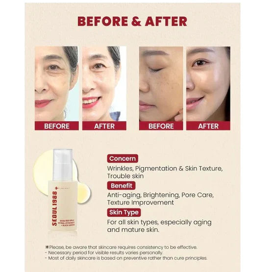 SEOUL 1988 Eye Cream β Retinal Liposome 4% + Fermented Bean