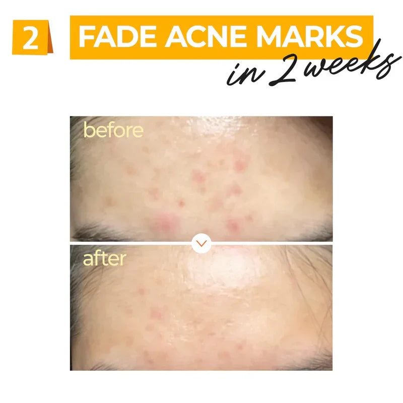 Numbuzin No.5 Vitamin Concentrated Serum 30ml